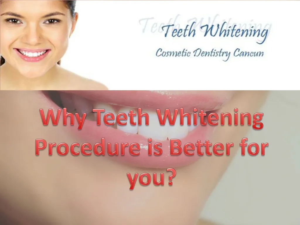 why teeth whitening procedure is better for you