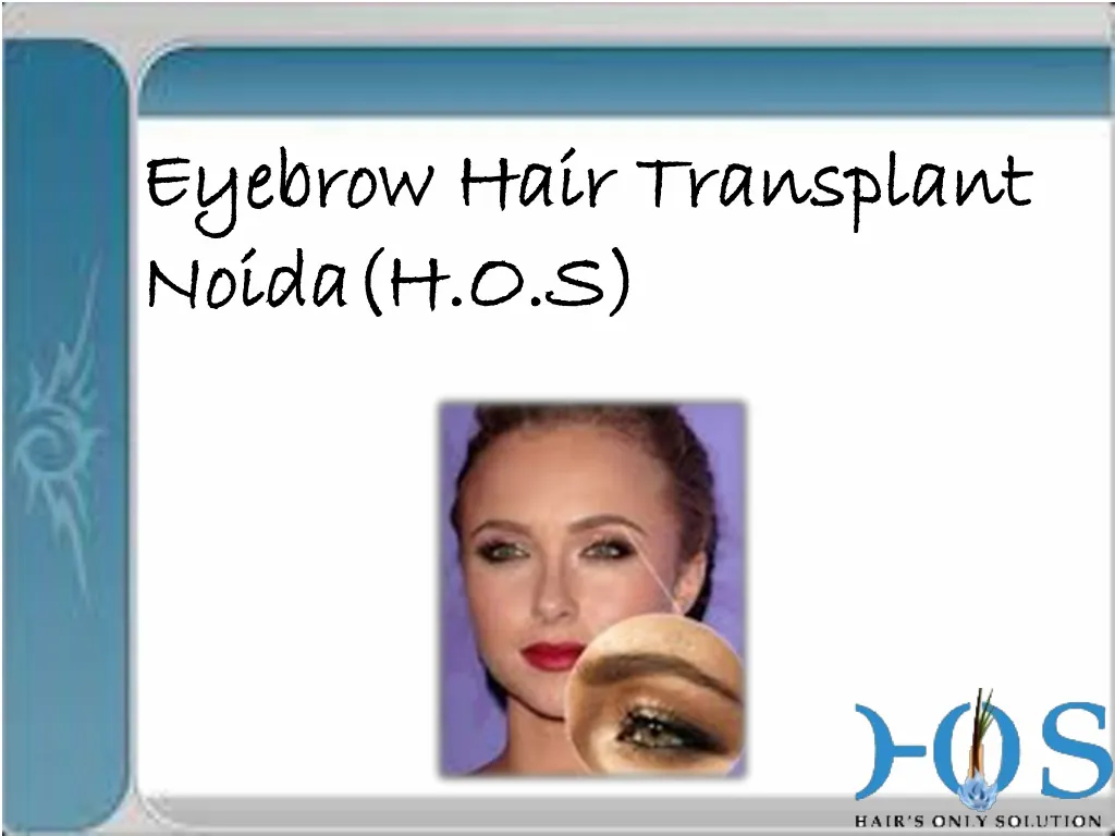 eyebrow hair transplant noida h o s