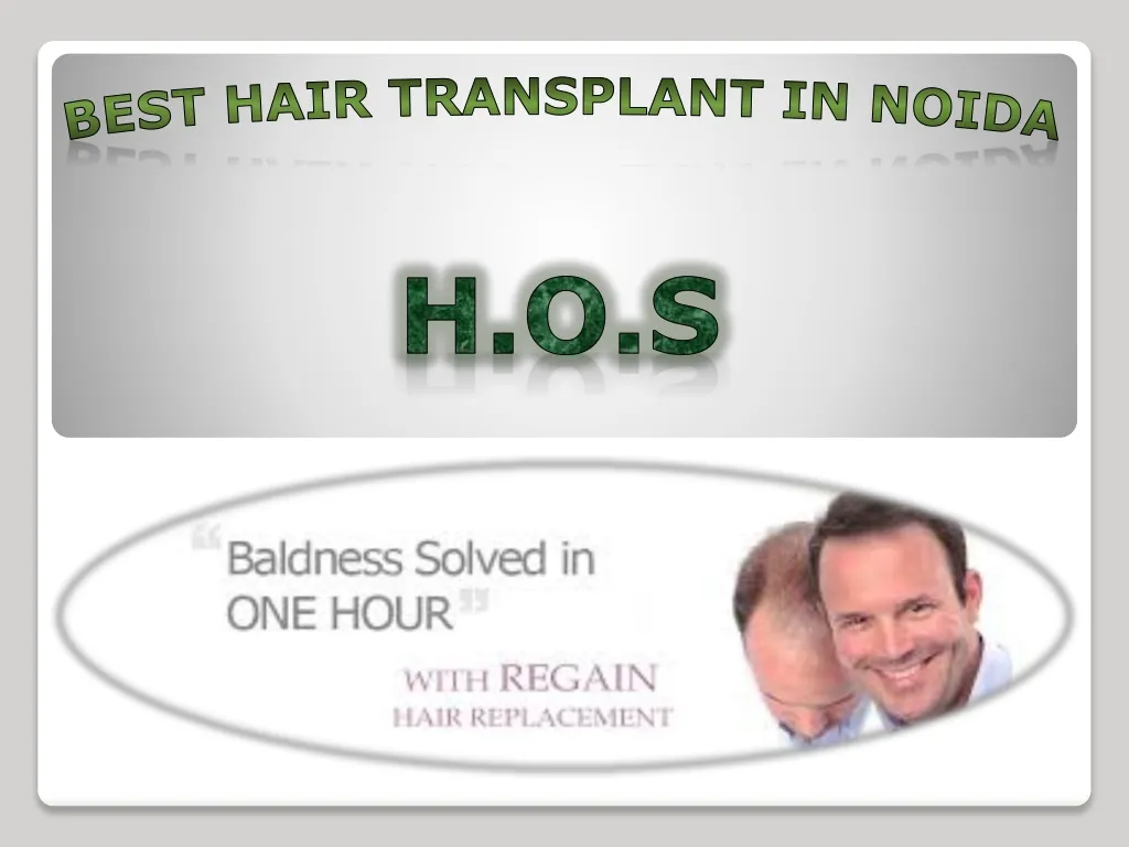 best hair transplant in noida