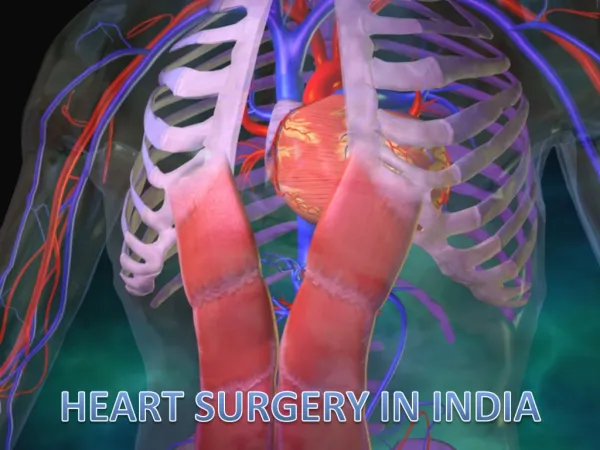 Surgery in India | India Heart Surgery