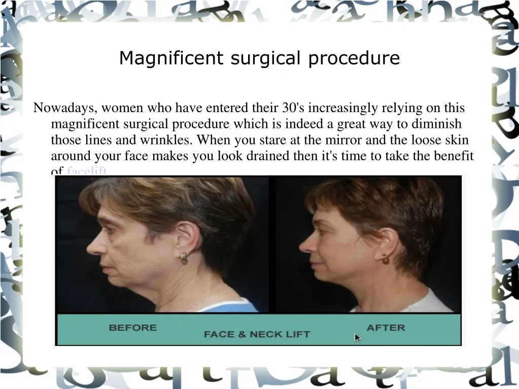 magnificent surgical procedure