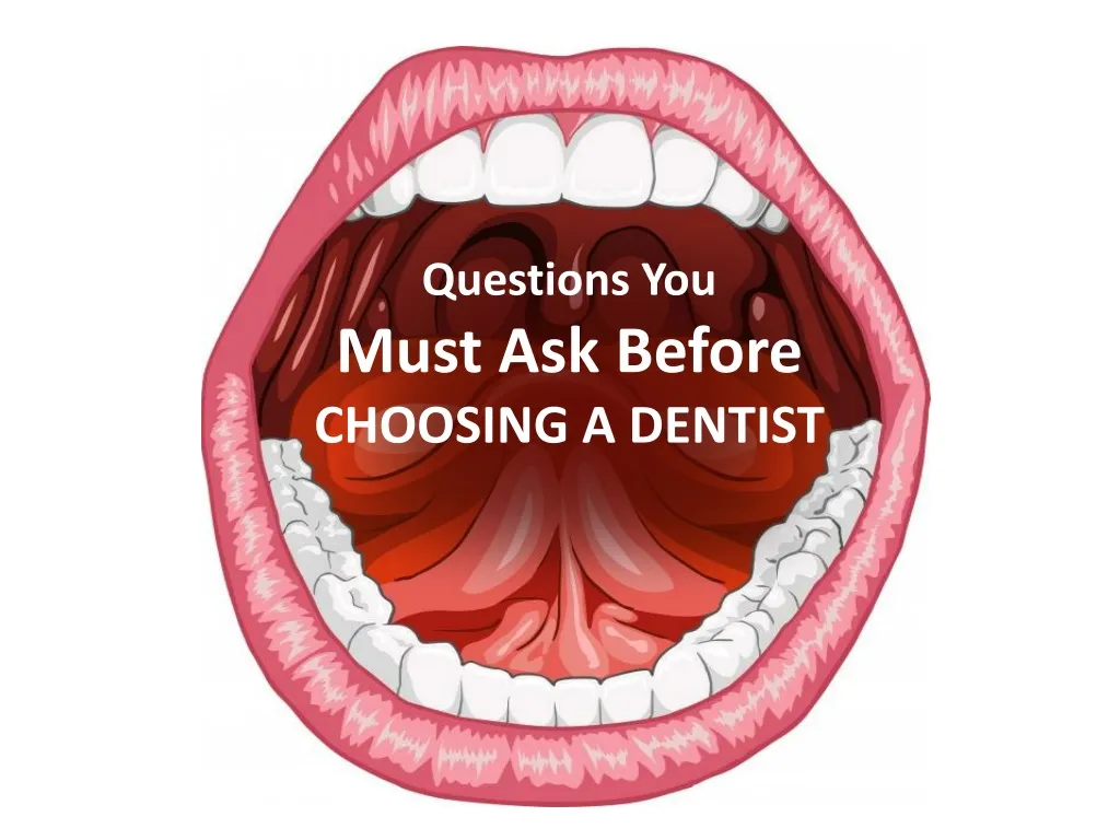 questions you must ask before choosing a dentist