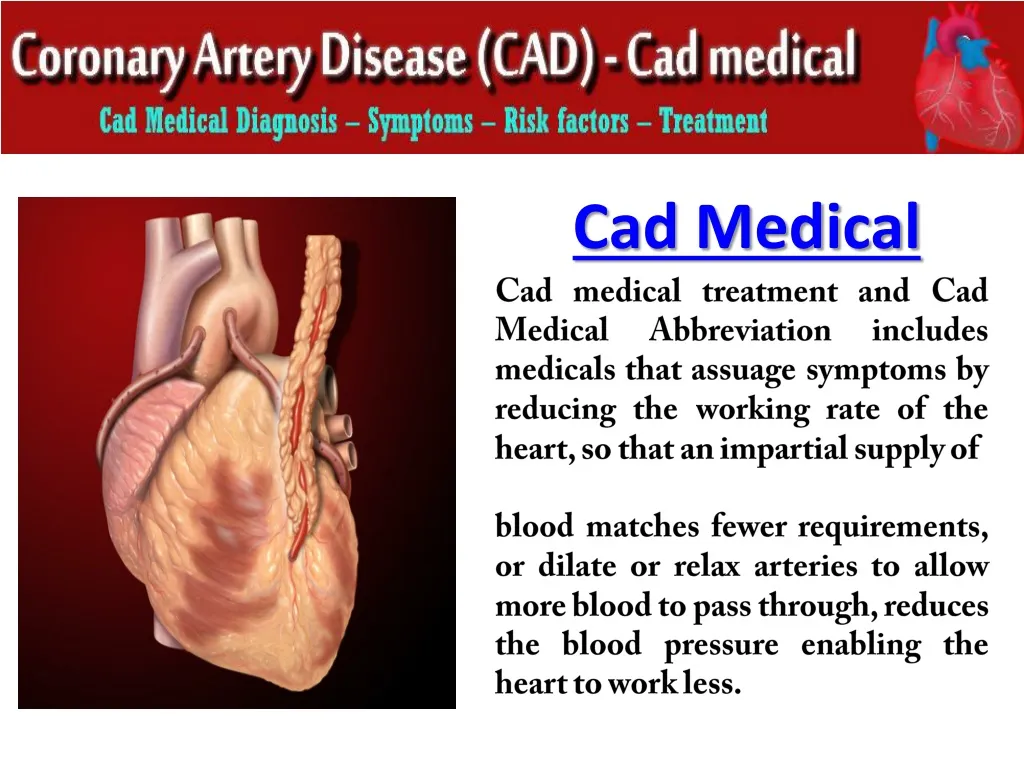 cad medical