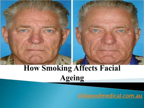 How Smoking Affects Facial Ageing