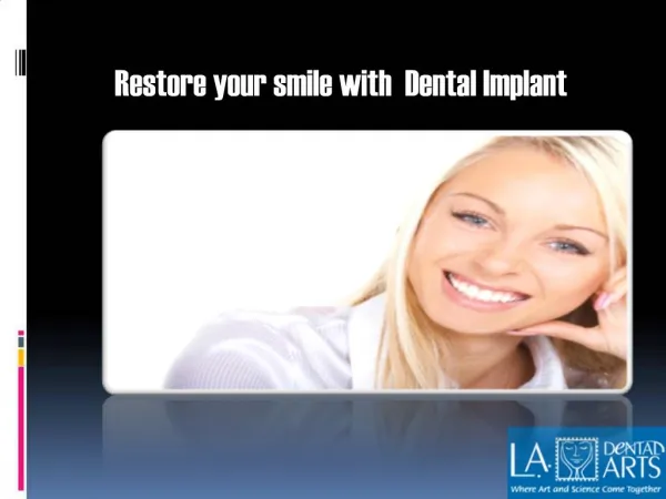 Dental Implants In Woodland Hills