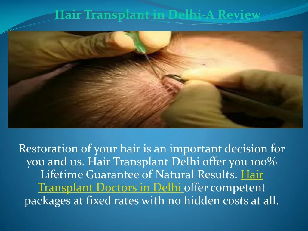 hair transplant in delhi a review