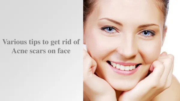Various tips to get rid of Acne scars on face