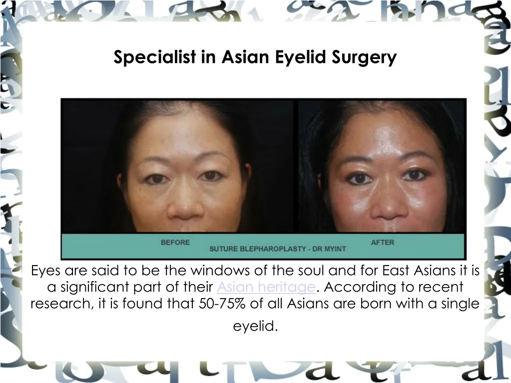 specialist in asian eyelid surgery