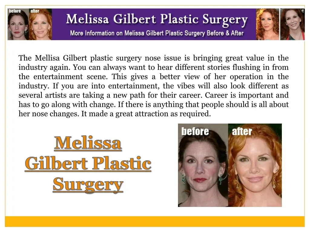 the mellisa gilbert plastic surgery nose issue