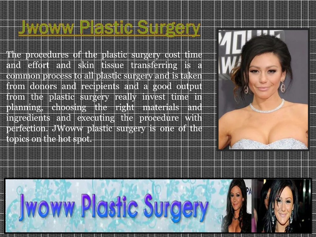 jwoww plastic surgery