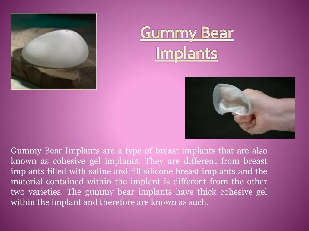 gummy bear implants