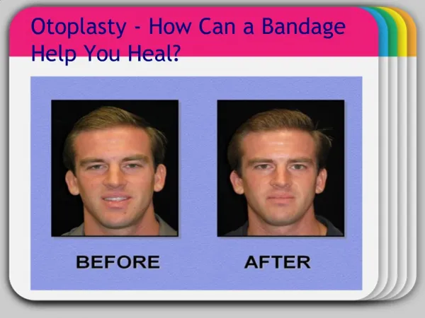 Otoplasty - How Can a Bandage Help You Heal