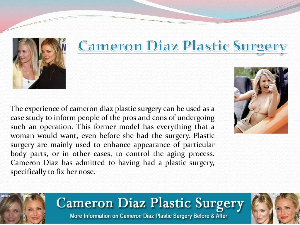 cameron diaz plastic surgery