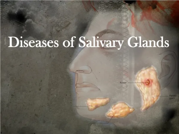 Diseases of Salivary Glands