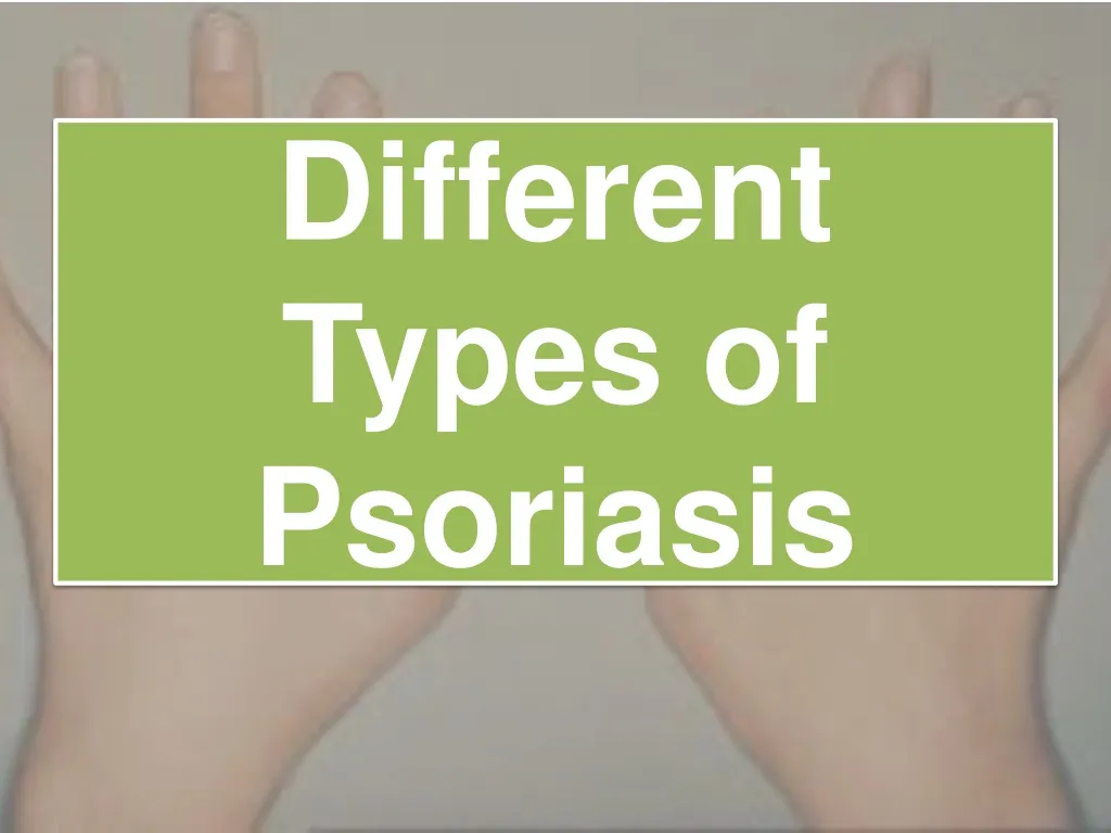 different types of psoriasis