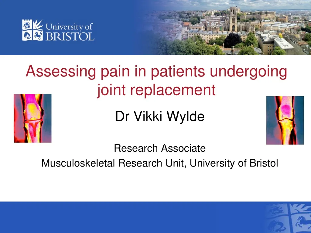 assessing pain in patients undergoing joint replacement