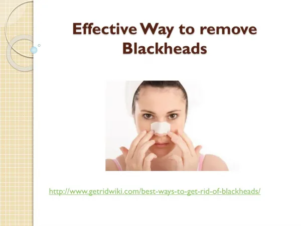 Effective Way to remove Blackheads