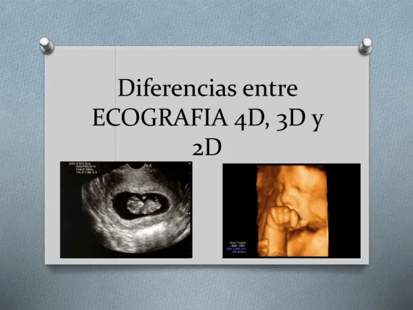 Ecografia 4D, 3D Y 2D. Diferencias
