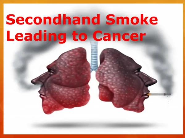 Second Hand Smoke Leading to Cancer