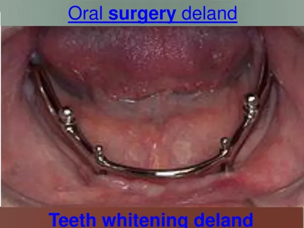 oral surgery deland