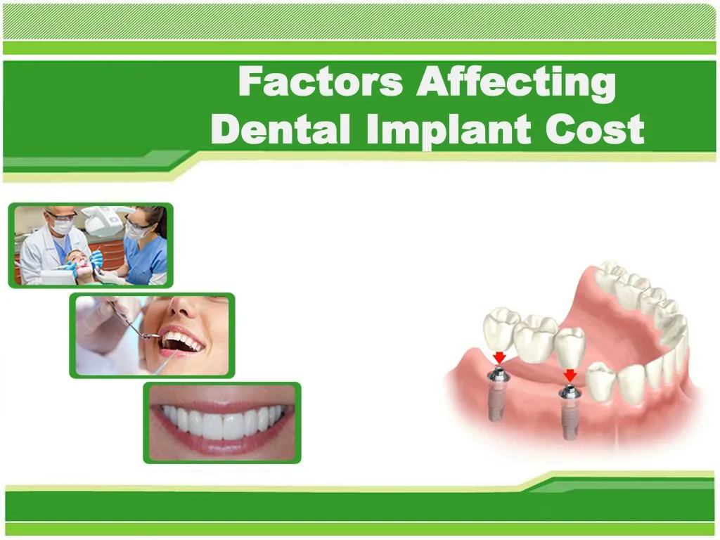 factors affecting dental implant cost
