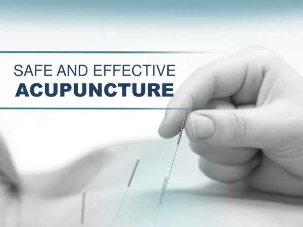 Acupuncture in Sunnyvale – Safe and Effective Therapy