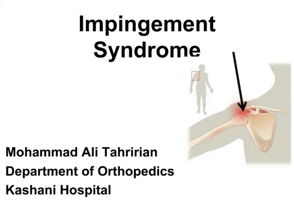 PPT - Impingement Syndrome PowerPoint Presentation, Free Download - ID ...