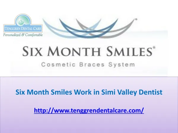 Six Month Smiles Work in Simi Valley Dentist