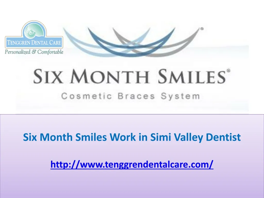 six month smiles work in simi valley dentist http