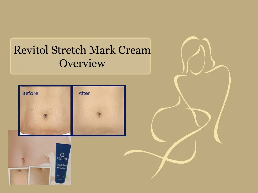 revitol stretch mark cream overview