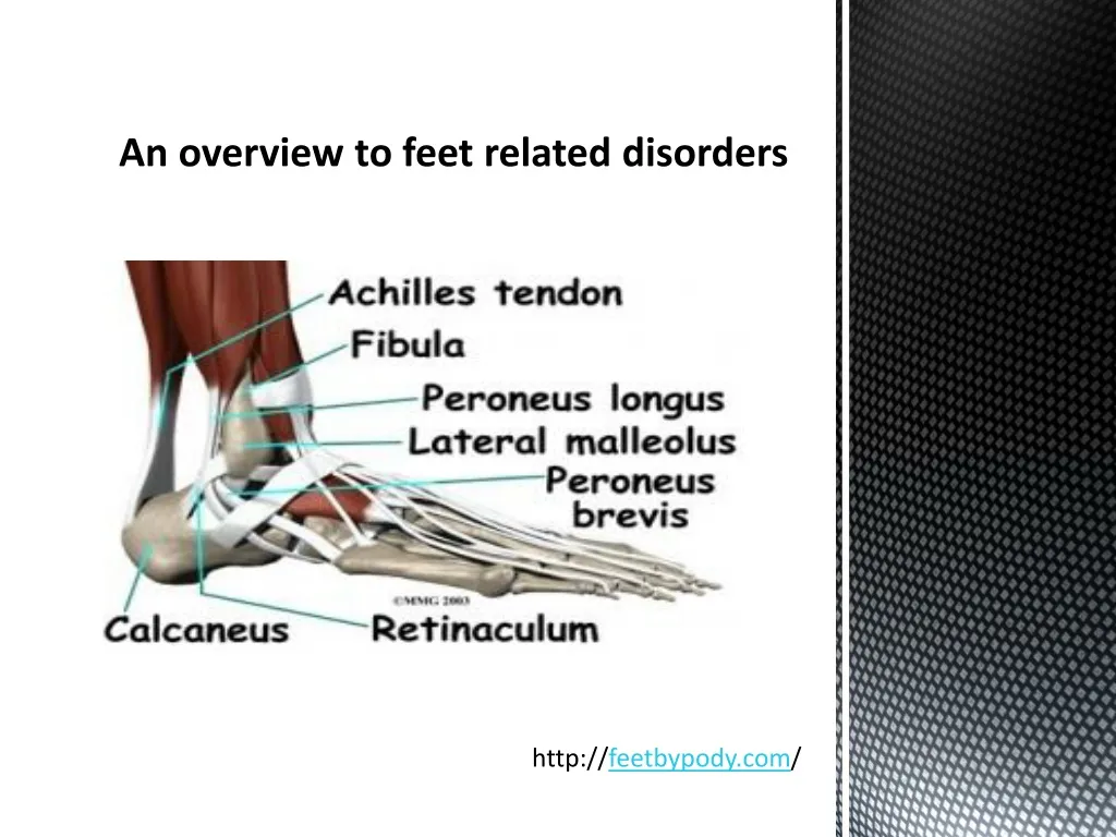 an overview to feet related disorders