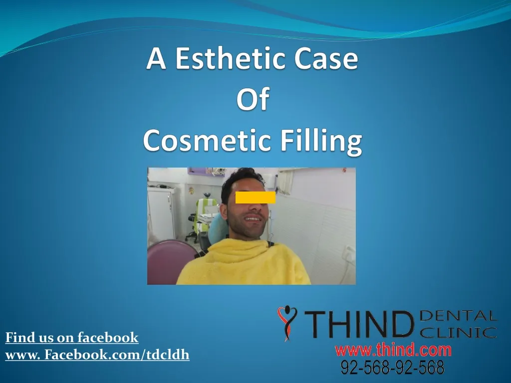 a esthetic case of cosmetic filling