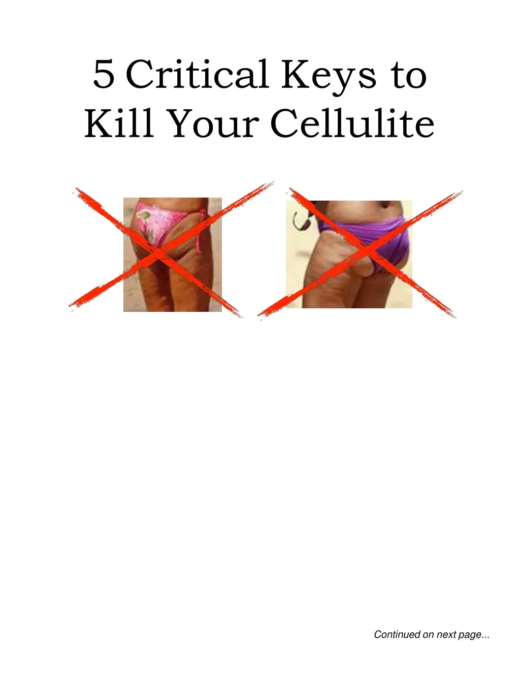 5 critical keys to kill your cellulite