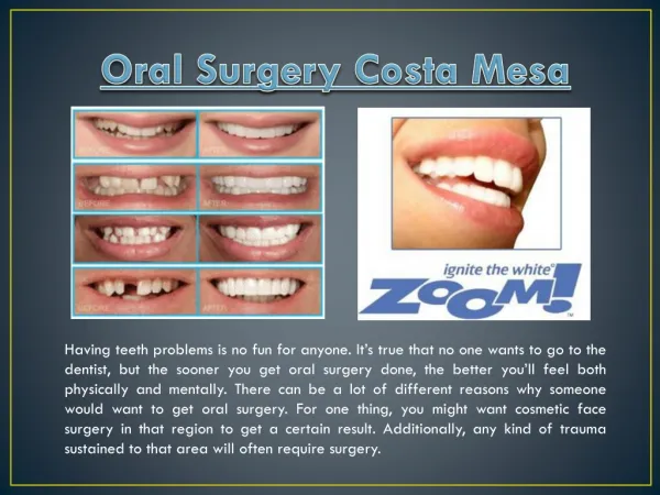 Oral Surgery In Costa Mesa