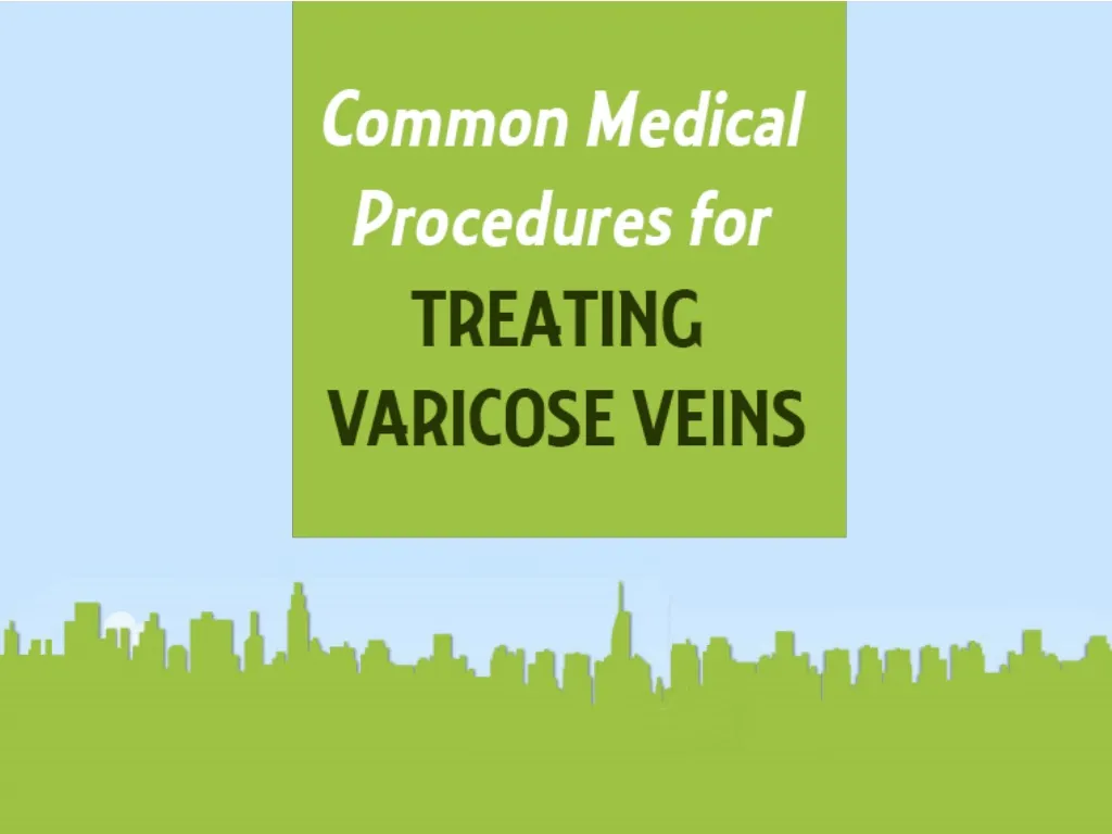 common medical procedures for treating varicose veins