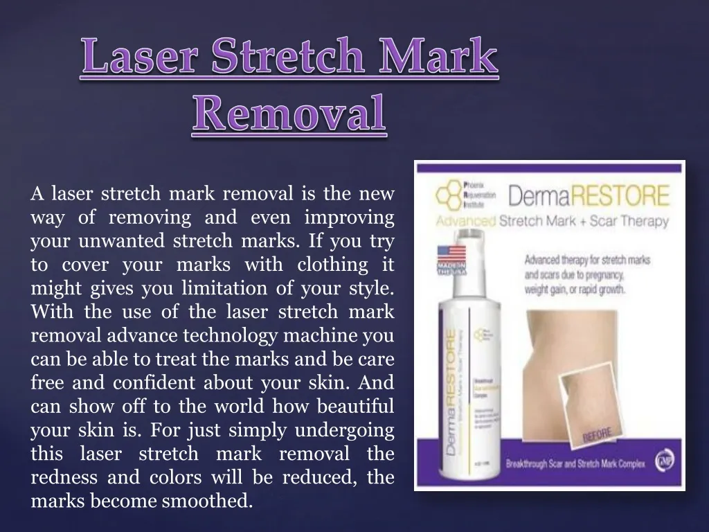 laser stretch mark removal