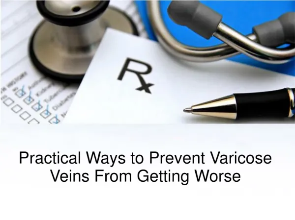 Practical Ways to Prevent Varicose Veins From Getting Worse
