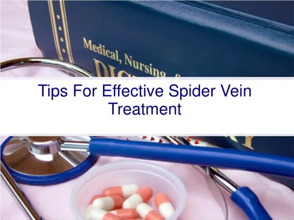 Tips For Effective Spider Vein Treatment
