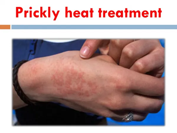Prickly Heat Treatment with natural herbs - Herbal Remedies