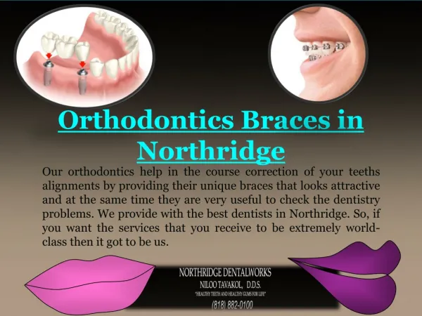 Orthodontics Braces in Northridge