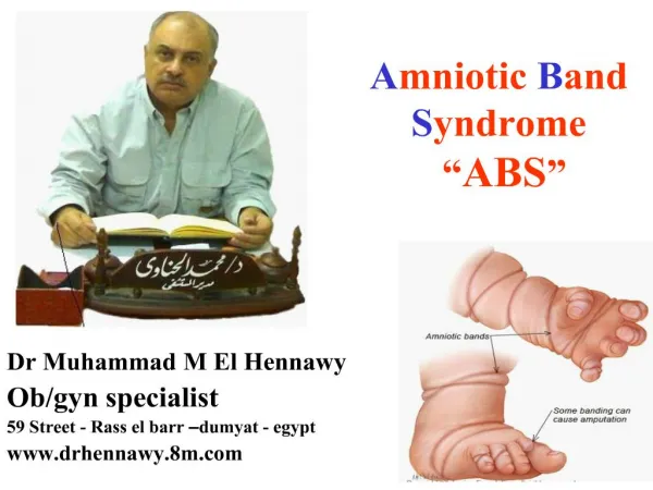 amniotic band syndrome abs