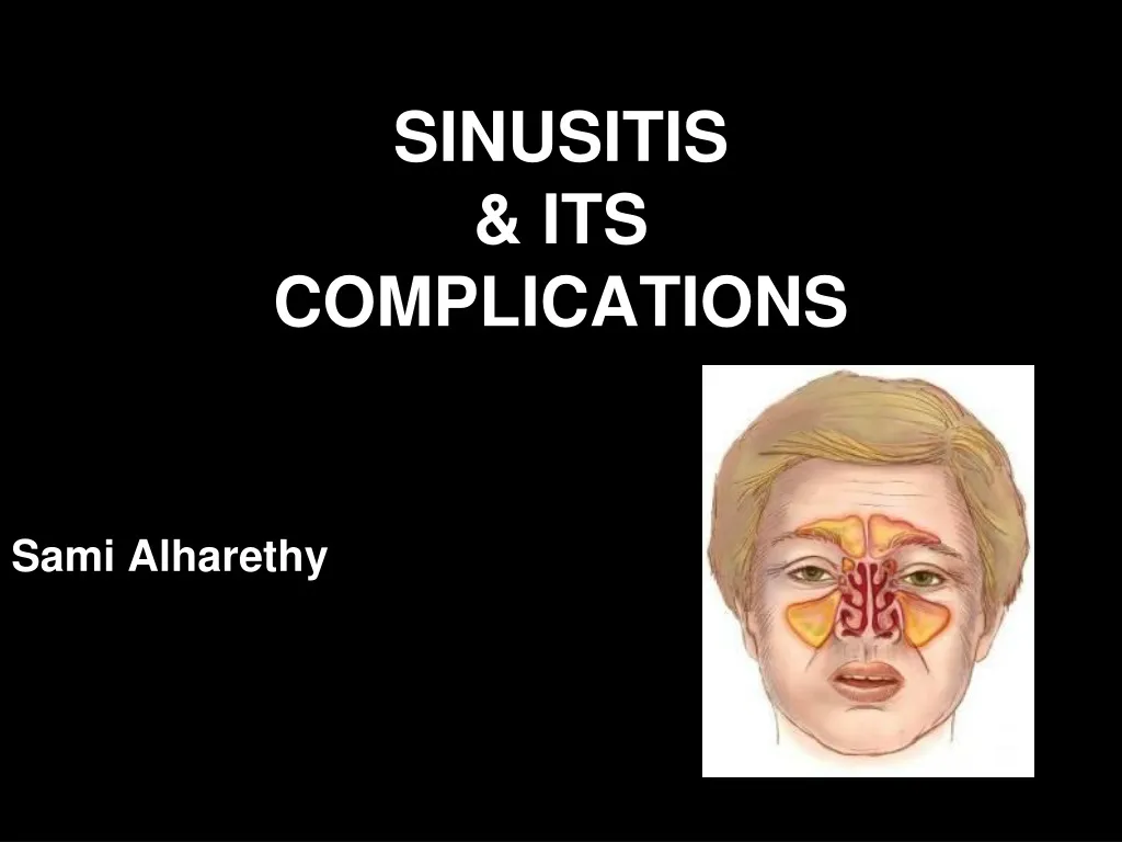 sinusitis its complications