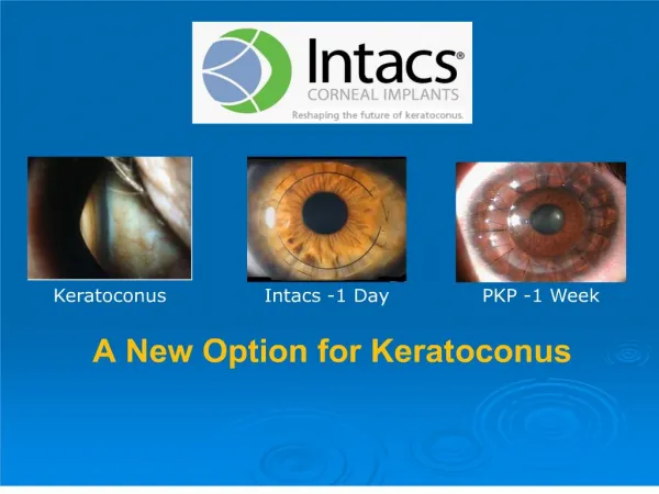 a new option for keratoconus