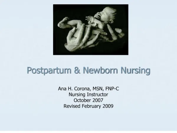 postpartum newborn nursing