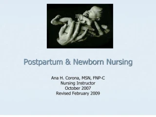 postpartum newborn nursing - slide 1