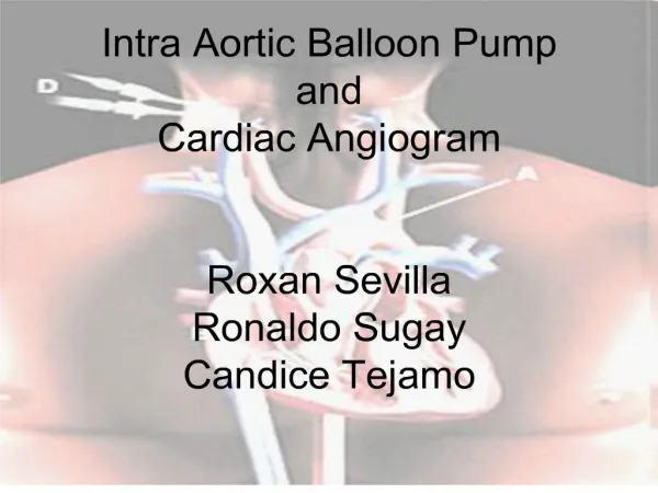 intra aortic balloon pump and cardiac angiogram roxan sevilla ronaldo sugay candice tejamo