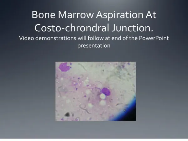 Bone Marrow Aspiration At Costo-chrondral Junction. Video demonstrations will follow at end of the PowerPoint presentat