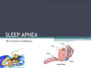 PPT - Neonatal Apnea PowerPoint Presentation, free download - ID:5406187