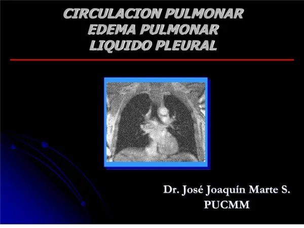 CIRCULACION PULMONAR EDEMA PULMONAR LIQUIDO PLEURAL