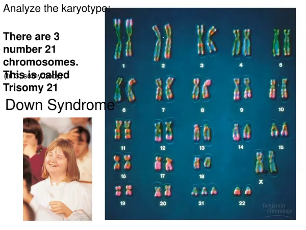 There are 3 number 21 chromosomes. This is called Trisomy 21